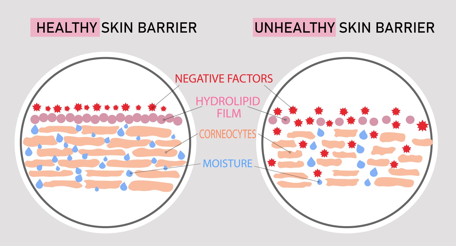 HydraFacial | An illustration of a healthy skin barrier versus an unhealthy skin barrier.