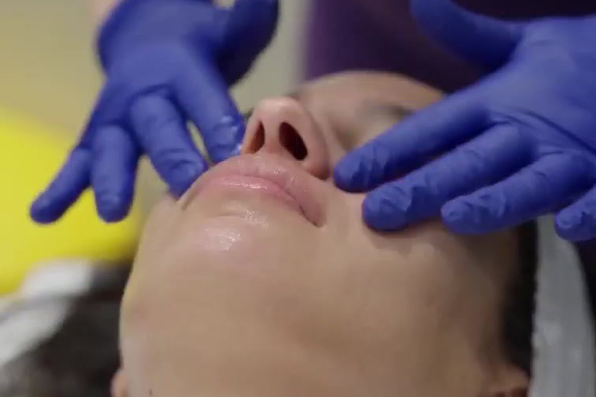 What Can I Expect After a HydraFacial?