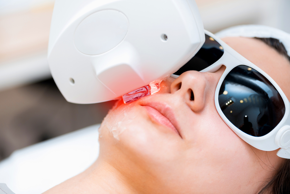Dye‑VL Laser | Dr Hala Medical Aesthetics London