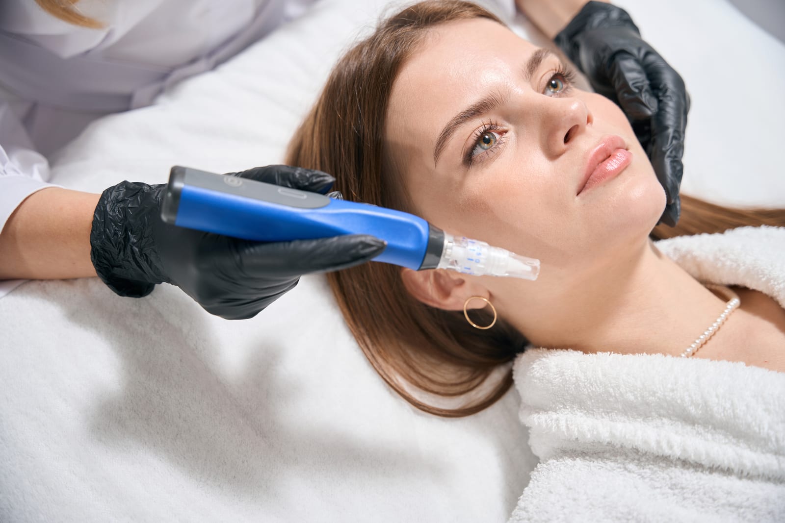 Polynucleotide | A close-up shot of a woman having a SkinPen microneedling treatment.