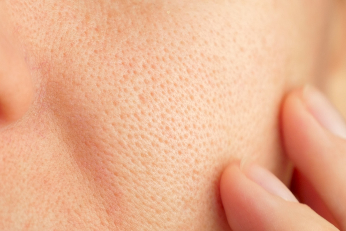 How to Reduce the Appearance of Large Pores