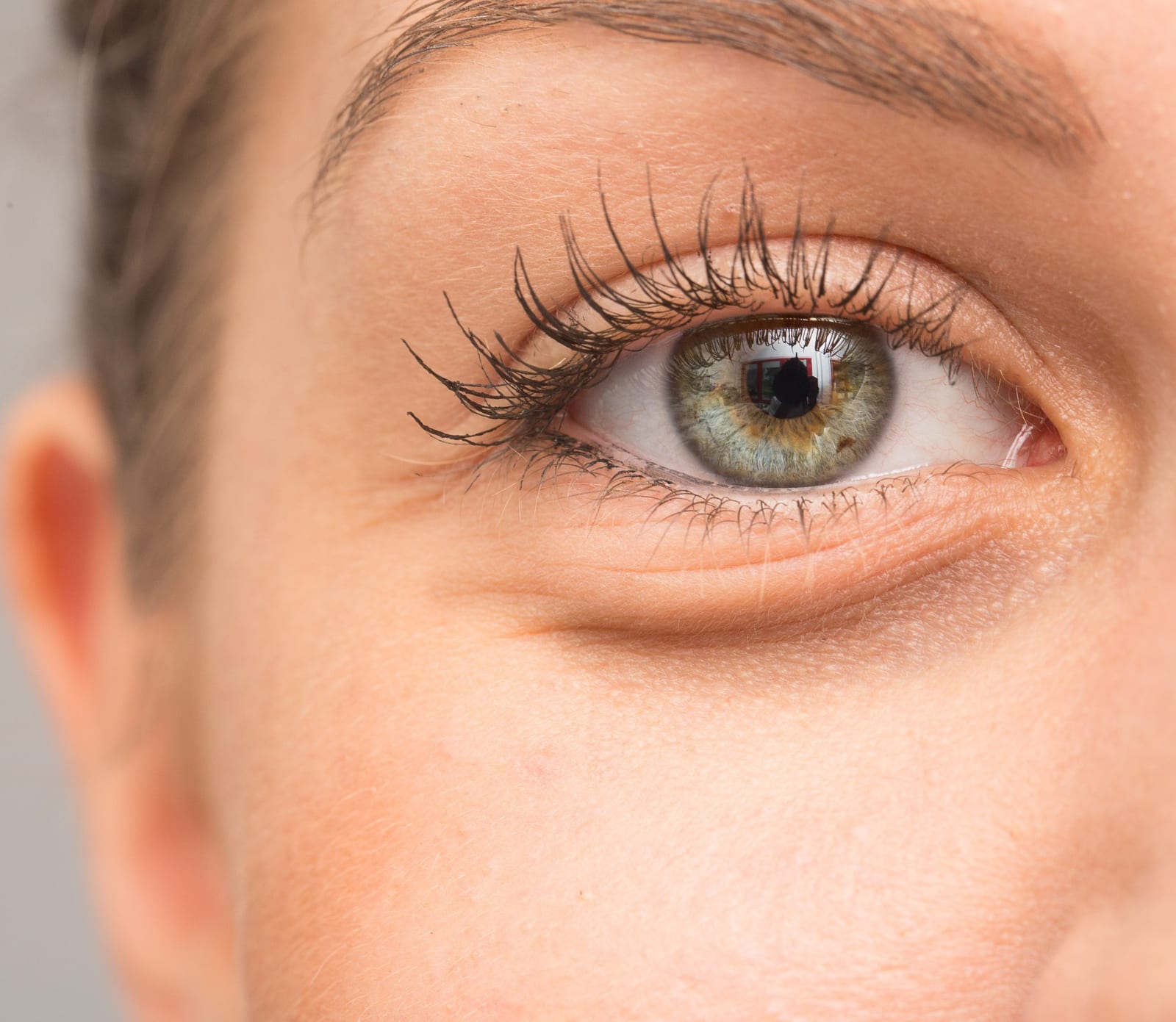 Dark Circles | A close-up picture of a female eye with dark circles.