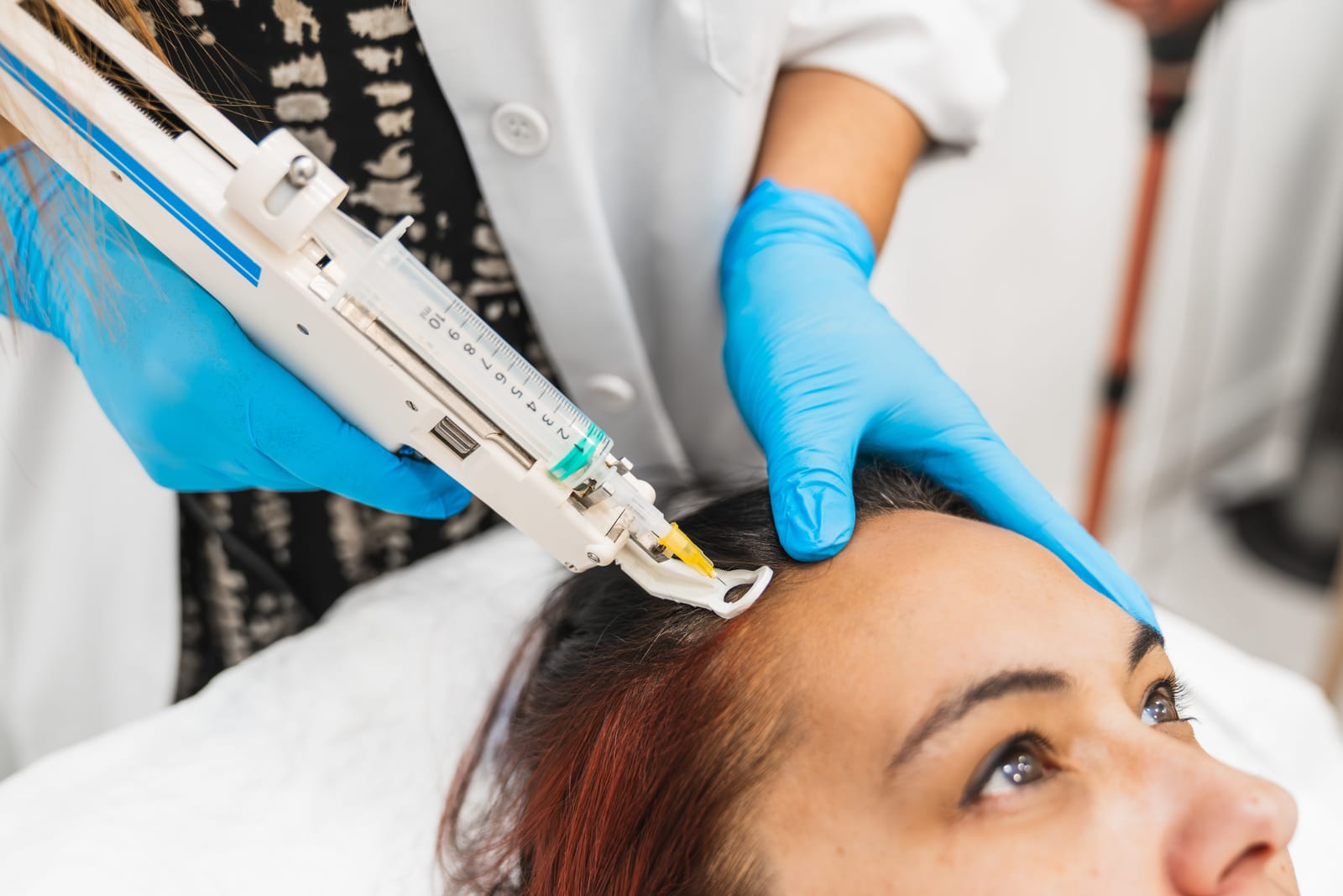 PRP Hair Treatment | Dr Hala London