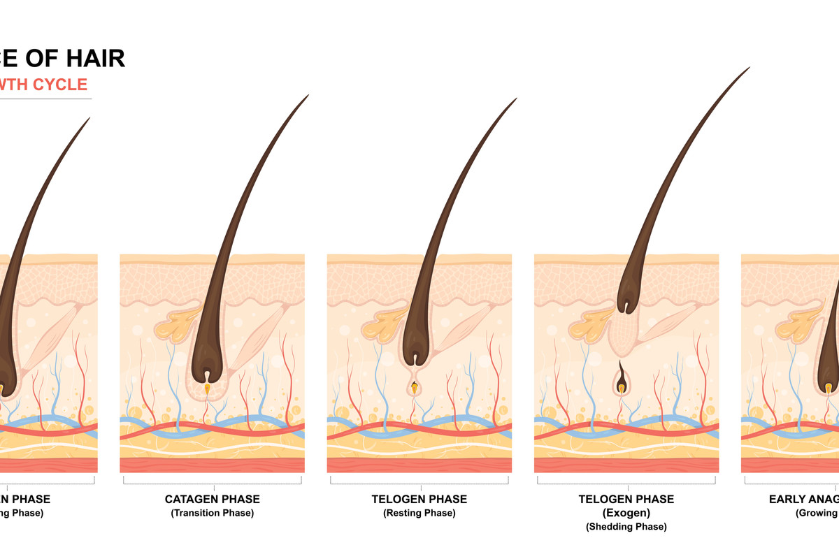 Reverse Your Hair Loss with This Combination Treatment