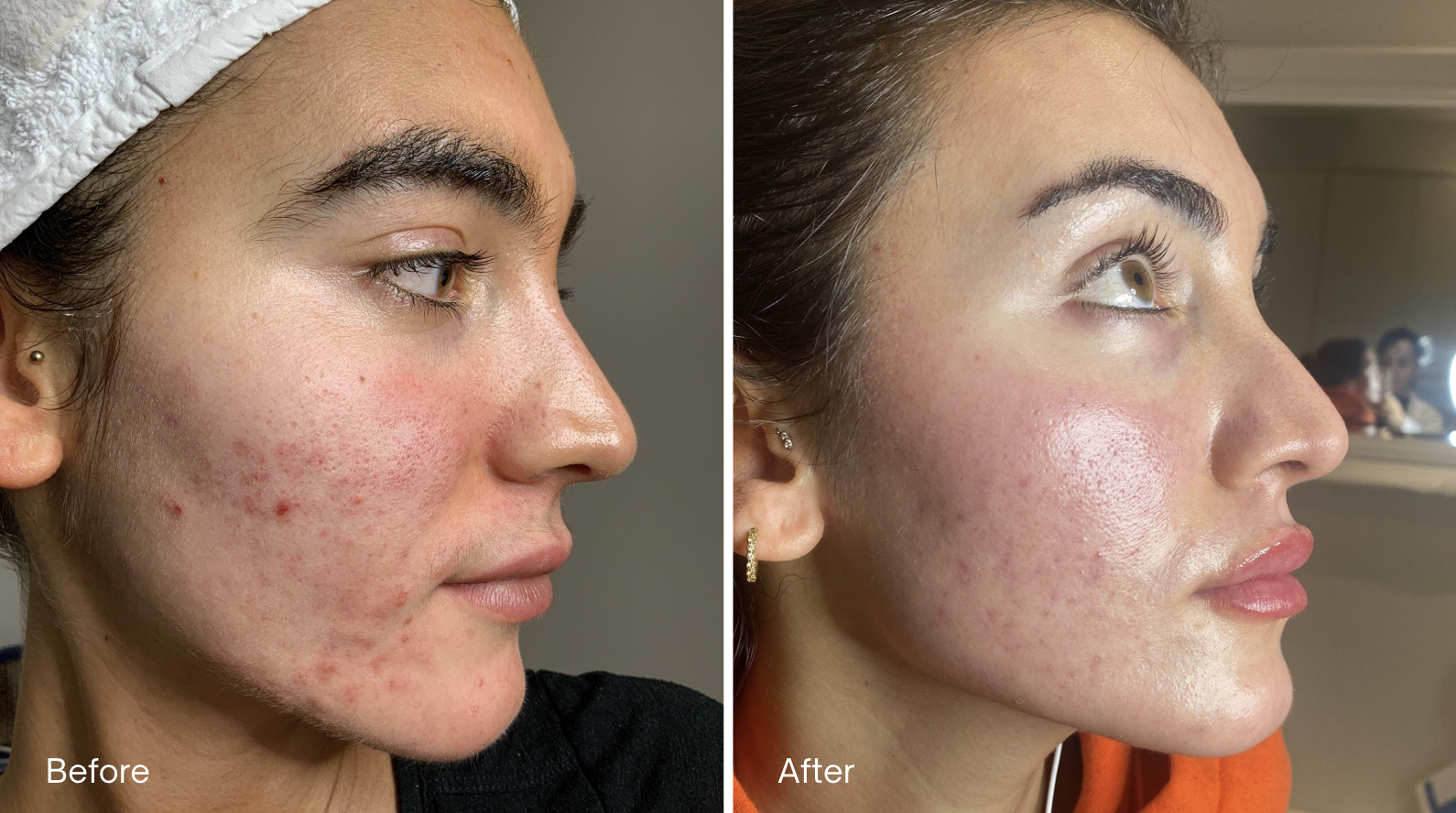 The Importance of Regular Facial Treatments