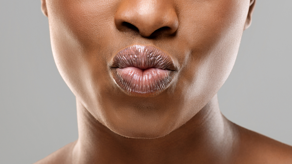 Lip Fillers | Dr Hala Medical Aesthetics London