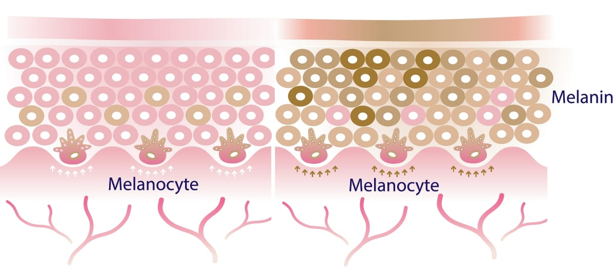 Exosome | An illustration of skin with varying levels of melanin to show how it affects skin tone.